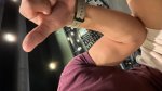 arm arm